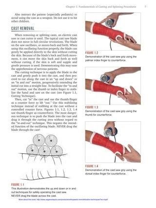 ortho glass splinting manual pdf